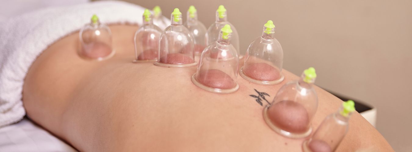 Cupping therapy treatment for injury