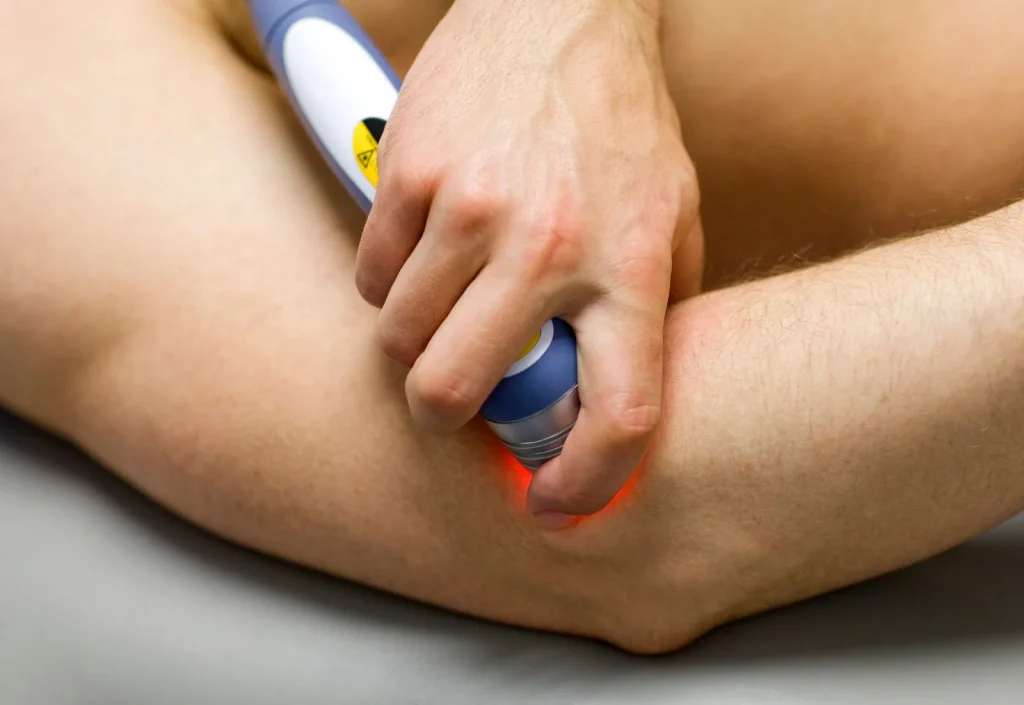 deep tissue laser therapy